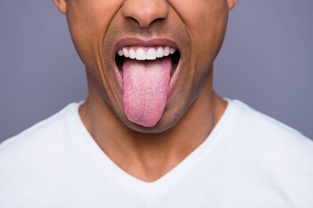 why is my tongue white