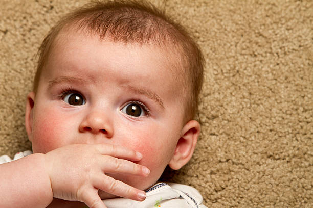 Teething Rash in Babies