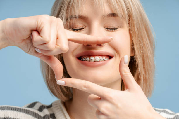 Permanent Retainer