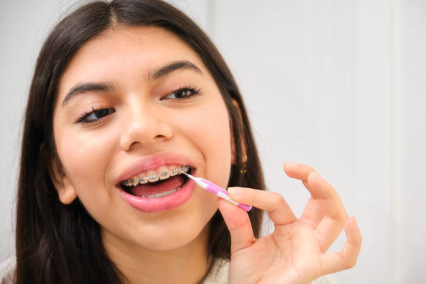 Permanent Retainer