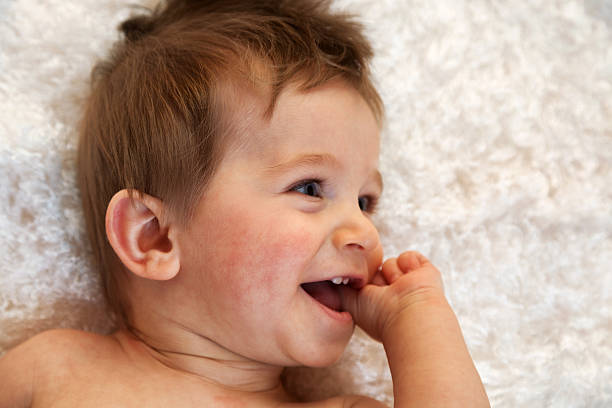 Teething Rash in Babies